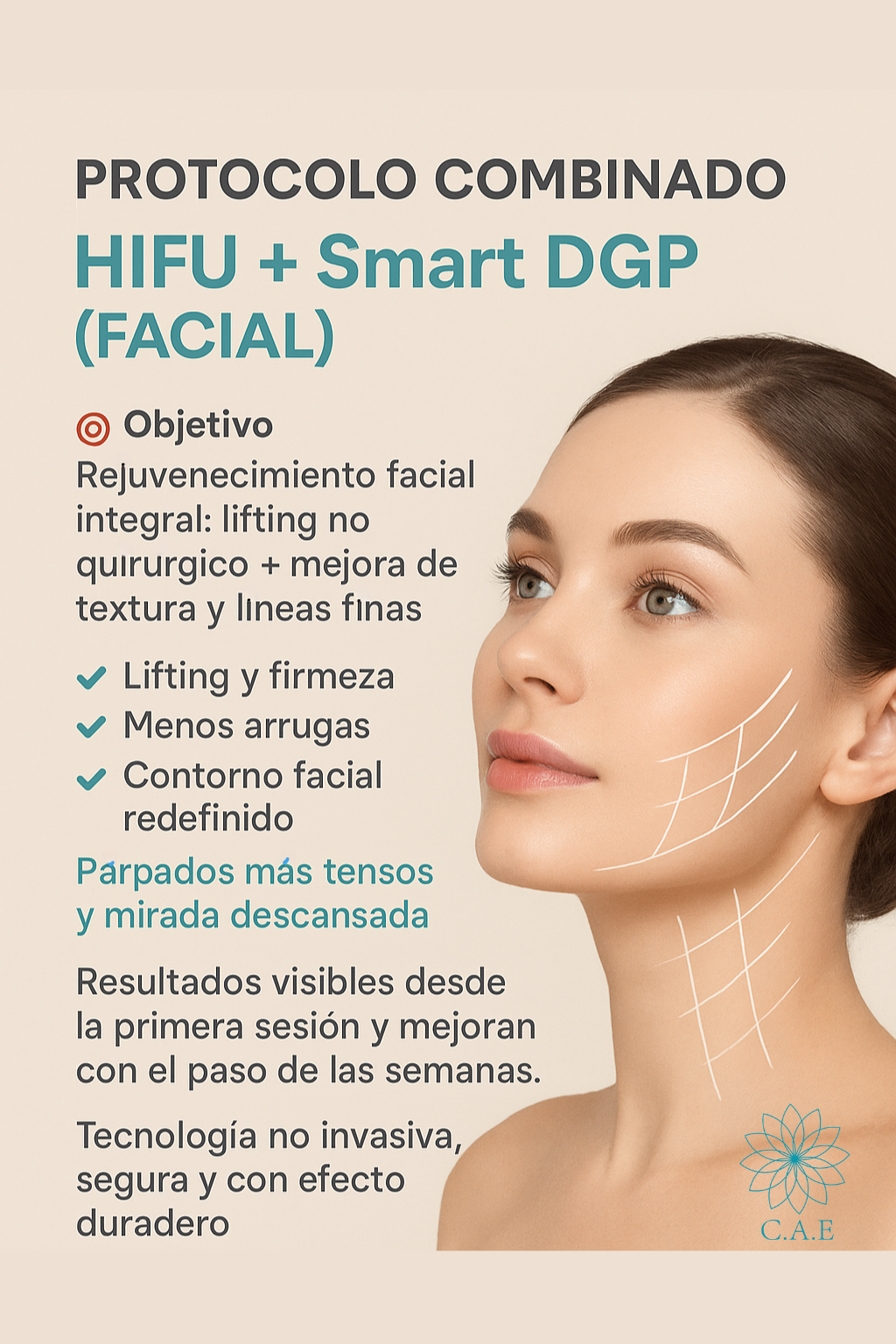 Protocolo_combinado_hifu_dgp
